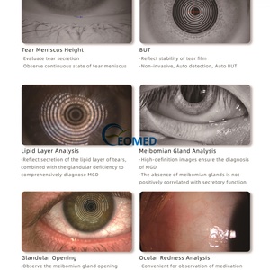 Testeur et détecteur complet et polyvalent pour l'analyse de la sécheresse oculaire tout-en-un, du lacrimal au gland, outil de diagnostic de la sécheresse oculaire DEA-800 - Product Image 4