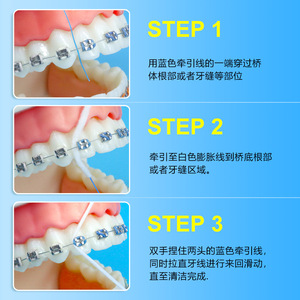 Fil dentaire orthodontique 50M, fil d'expansion jetable pour le nettoyage des appareils dentaires - Product Image 1