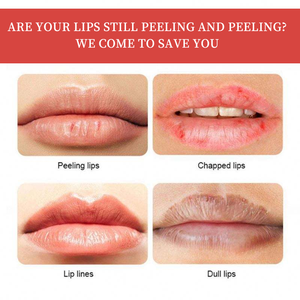 <span class=keywords><strong>Masque</strong></span> de nuit pour les lèvres nourrissant biologique longue durée à la papaye et à la mangue pour les lèvres gercées et sèches - Product Image 5