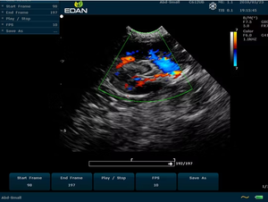 Edan Veterinary Ultrasound U50 Vet Buen <span class=keywords><strong>Precio</strong></span> de buena calidad Batería de litio portátil Color Doppler Ultrasonido veterinario - Product Image 5