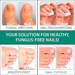 Marque privée herbacée naturelle soin des ongles essence réparation des ongles <span class=keywords><strong>traitement</strong></span> fortifiant <span class=keywords><strong>traitement</strong></span> <span class=keywords><strong>antifongique</strong></span> des ongles - Product Image 6