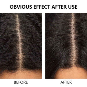 Sérum pour cuir chevelu au vinaigre <span class=keywords><strong>de</strong></span> <span class=keywords><strong>cidre</strong></span> <span class=keywords><strong>de</strong></span> pomme biologique OEM ODM gingembre à base <span class=keywords><strong>de</strong></span> plantes menthe poivrée riz <span class=keywords><strong>eau</strong></span> détoxifie les équilibres hydrater les démangeaisons du cuir chevelu - Product Image 5