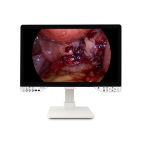 27 Inch FHD All in One <strong>Endoscope</strong> Camera System CE Certified with Cold Light Source for Hysteroscopy