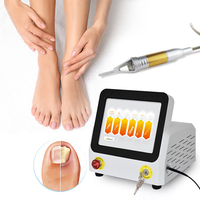 Top vente OEM ou ODM Service 980nm Diode Laser Machine élimination des champignons des ongles traitement de l'onychomycose