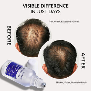 Sérum stimulant la repousse des cheveux du Moyen-Orient, bloque le DHT, augmente la densité, cible la calvitie masculine pour cuir chevelu sec et usage Halal - Product Image 5