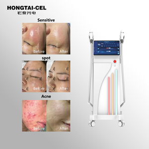 Dispositivo Fotónico con Filtro de 9 Bandas 400-1400nm, Dos Manijas, Uso en Salón y Clínica <span class=keywords><strong>para</strong></span> Acné, Pigmentación, Depilación y Rejuvenecimiento de la Piel - Product Image 1