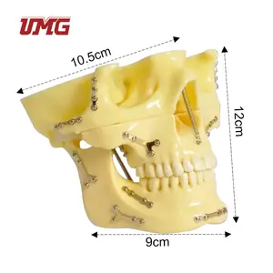 Модель черепа с титановой пластиной для практики имплантата с фиксированным переломом