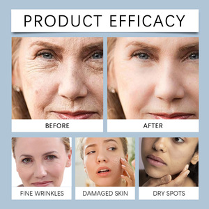 HOYGI Soin du visage Offre Spéciale Fade Fine Ridules Lift Nourish Hydrater Firmen Sérum hydratant et anti-rides - Product Image 2