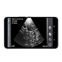 Máquina de ultrasonido de mano Cerdo Oveja Escáner de ultrasonido veterinario mecánico inalámbrico Prueba de embarazo portátil