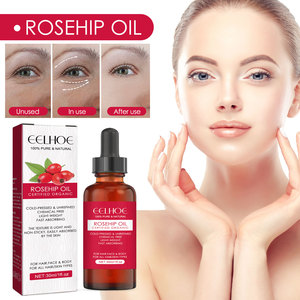 EELHOE rosa canina olio essenziale per la cura della pelle del viso idratante del corpo e cura dei capelli massaggio balsamo prodotto - Product Image 2