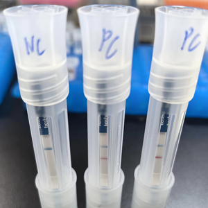 Kit de Prueba Rápida de Tuberculosis (TB) de Alta Sensibilidad, Detección de Ácido Nucleico MTBC por RPA LFA, Resultados Rápidos en 10 Minutos - Product Image 1