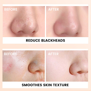 Gel exfoliant pour le visage personnalisé, gel exfoliant naturel végétalien pour le corps, exfoliant pour le visage et le corps, nettoyant pour la peau - Product Image 4