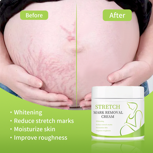 プライベートブランド ハーブ産後ストレッチマーク除去クリーム しわ対策 肌修復 傷跡除去 妊娠線クリーム 全身用 - Product Image 2