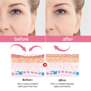 Venta al por mayor 30ml Advance Skin Care Face <span class=keywords><strong>Serum</strong></span> Even Skin Tone Reduce las arrugas Reafirmante 5 en 1 Facial <span class=keywords><strong>Serum</strong></span> - Product Image 4