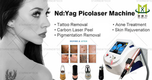 Máquina de depilación de electrólisis portátil con láser Qswitch 755/1320nm/1064nm para rejuvenecimiento de la piel facial láser de eliminación de tatuajes - Product Image 2
