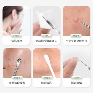 Juego de 5 agujas para acné Haishi Hainuo de acero inoxidable para la extracción de puntos negros y comedones - Product Image 2