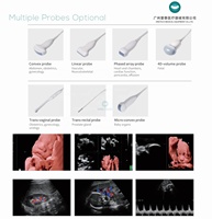Appareil d'échographie obstétricale 2D 3D 4D 5D haut de gamme Onetech certifié CE C56 pour hôpital et clinique avec garantie de 2 ans