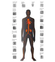 Simulador de Entrenamiento para Intervención Vascular Haptica, Sin Radiación, para Neurocirugía, Cardiología y Cirugía Periférica, para Enseñanza de Residentes