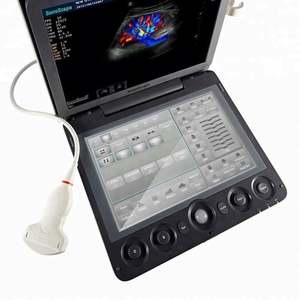 <span class=keywords><strong>Sonoscape</strong></span> S9 Hoge Resolutie Echografie Machine Ultrasonido Kleur Doppler Systeem Met Sonde - Product Image 5