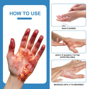 Crème nourrissante pour les plaies à base de plantes avec de la vitamine E pour la réparation de la peau endommagée et l'utilisation corporelle 20G - Product Image 5