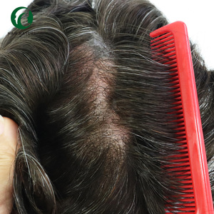 Sistema di Sostituzione <span class=keywords><strong>Capelli</strong></span> Uomo Ultra Sottile 0.03-0.04mm in Poliuretano con Base in <span class=keywords><strong>Pelle</strong></span> Naturale, Toupet Maschile in <span class=keywords><strong>Capelli</strong></span> Umani - Product Image 5