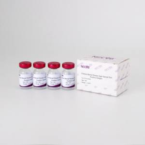 전염성 Bursal 질병 (IBD) <span class=keywords><strong>AGP</strong></span> 양성 혈청-한천 젤 면역 확산 검사용, 높은 항체 역가, OIE 표준 - Product Image 4