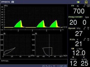 Machine d'anesthésie de haute qualité à partir de matériel médical équipements d'anesthésie et accessoires - Product Image 6