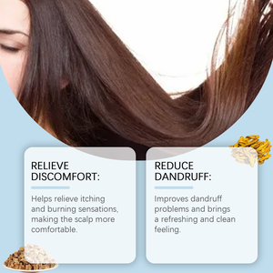 Crème de Soin Capillaire Anti-Pelliculaire Apaisante à Marque Blanche en Gros – Crème Capillaire à l'Huile de Jojoba pour Soulager les Démangeaisons du <span class=keywords><strong>Cuir</strong></span> <span class=keywords><strong>Chevelu</strong></span> (OEM) - Product Image 3