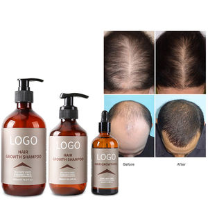Anti Hair Loss Plant Extract Professional Hair Growth Unisex Organic <strong>Shampoo</strong> - Product Image 5