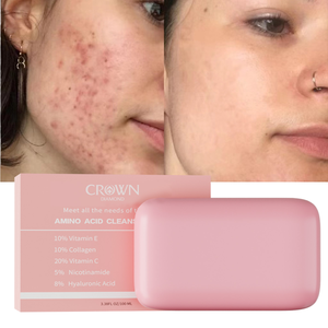 Savon pour le visage 5 en 1 à base d'huile essentielle naturelle à base de plantes, éclaircissant, exfoliant, blanchissant, anti-acné, marque privée - Product Image 2
