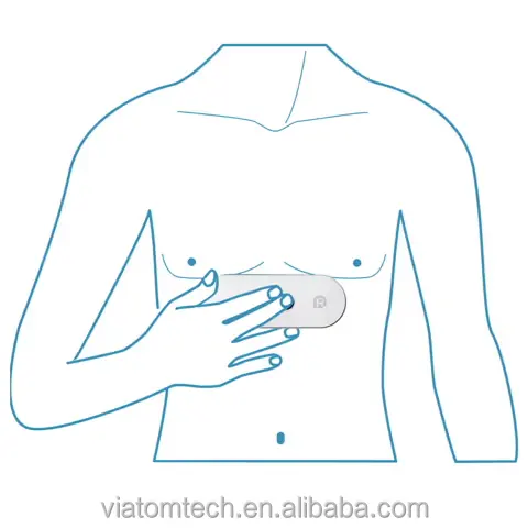 Viatom Holter Monitor Ecg Monitor Ekg Monitor portátil Ecg Holter Recorder Share Report Personal Handheld Ecg