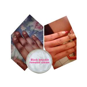 Sérum éclaircissant et hydratant pour les mains, les genoux, les coudes et les genoux foncés, Secret White pour <span class=keywords><strong>la</strong></span> vente en gros, usine cosmétique - Product Image 1