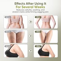 Nouvel outil de massage anti-cellulite pour masseur corporel, réduit les vergetures et la cellulite, pour les jambes, les bras et le ventre, machine à sculpter le corps