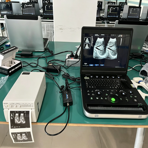 Ecógrafo Portátil, Ecografo OB/GYN, Doppler Color 3D, Precio de la Máquina de Ultrasonido Mindray - Product Image 5