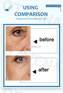 Crème pour les yeux instantanée OEM ODM, <span class=keywords><strong>anti</strong></span>-rides, soin de la peau, peptide, gel pour les yeux pour hommes et femmes - Product Image 3