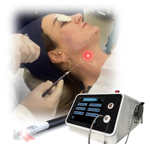 Endolaser Doble mentón debajo de los ojos Comprobar Quemar grasa Apriete la piel Estiramiento facial Máquina de liposucción láser facial 1470nm Láser de diodo - Product Image 1