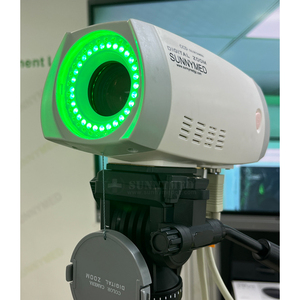 SY-F005HD-1 y tế di động HD âm đạo máy ảnh phụ khoa video kỹ thuật số soi cổ tử cung cho phòng khám bệnh viện - Product Image 4