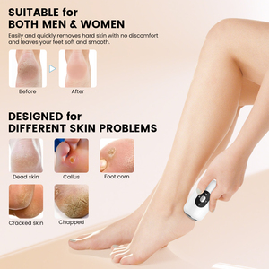 Vente en gros de lime à peaux mortes entièrement automatique pour enlever les callosités des pieds meuleuse de talon électroménager de soins personnels - Product Image 6