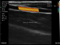 Scanner à ultrasons Doppler couleur sans fil pour chiens chats cochons moutons vaches chevaux équipement de diagnostic vétérinaire
