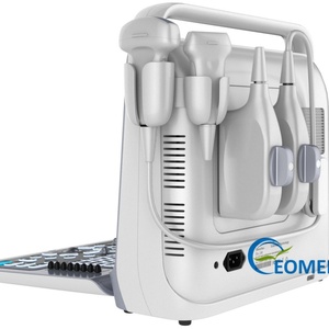 Portable Human Veterinary Ultrasound <b>Scanner</b> with Color Doppler Multi-Frequency Probe for Comprehensive Diagnostic CU60-1 - Product Image 4