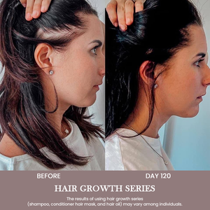 Shampooing anti-chute de cheveux Formule à l'huile de Batana Réduit la casse Renforce les follicules pileux <span class=keywords><strong>Hydrate</strong></span> <span class=keywords><strong>le</strong></span> <span class=keywords><strong>cuir</strong></span> <span class=keywords><strong>chevelu</strong></span> Favorise la croissance - Product Image 6