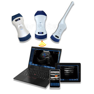 Sonde d'écographie à double tête Portable Color <span class=keywords><strong>Doppler</strong></span> Ultrasounido Convex <span class=keywords><strong>Transvaginal</strong></span> Pocket Vet <span class=keywords><strong>Ultrasound</strong></span> <span class=keywords><strong>Probe</strong></span> Wireless - Product Image 2