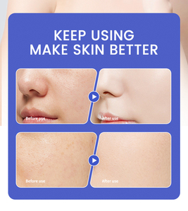 <span class=keywords><strong>Limpiador</strong></span> <span class=keywords><strong>Facial</strong></span> Coreano para el Cuidado de la Piel, Limpieza Diaria Suave, Hidratante, Blanqueador, Aclarante, Nutritivo e Hidratante - Product Image 4