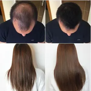 Minyak akar jahe minyak esensial alami murni untuk pertumbuhan rambut mengurangi otot harga grosir penjualan pabrik - Product Image 3