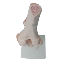 Science médicale arthrose anatomie pathologique PVC artificiel flexible taille réelle squelette humain modèle anatomique de l'articulation du genou
