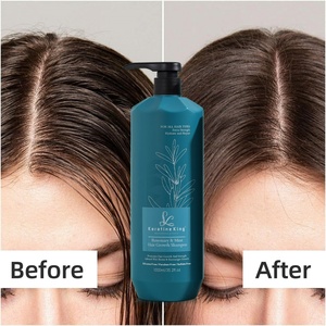 OEM ODM Private Label <b>Shampoo</b> Natural Rosemary Set Organic Vegan Ginger Hair <b>Shampoo</b> Clear Fluffy Oil-control Hair Care Set - Product Image 6