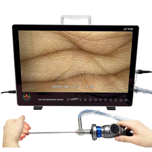 SY-PS050 Veterinary 1080p Medical Ent Endoscopy Endoscope Camera Full Hd  24 Inch Portable Endoscopic Camera System
