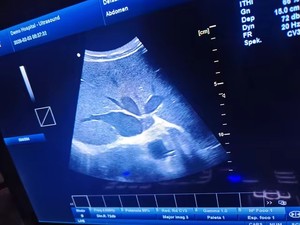 JM-906B Échographe Doppler Couleur à Haute Résolution d'Imagerie pour les Voies Vaskulaires Abdominales et les Petits Organes MSK, Sonde Linéaire, Appareil Doppler Couleur - Product Image 4