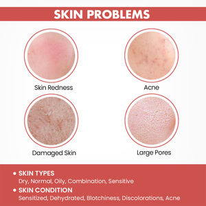 Réduire les rougeurs ensemble de soins de la peau sensible meilleurs produits <span class=keywords><strong>bio</strong></span> naturel rapide apaiser réparation restaurer la peau visage sérum ensemble de soins de la peau nouveau - Product Image 4