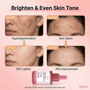 Suero Facial con Alfa Arbutina y Niacinamida, Aclara <span class=keywords><strong>la</strong></span> Hiperpigmentación y las Manchas Oscuras, Unifica <span class=keywords><strong>la</strong></span> Textura de <span class=keywords><strong>la</strong></span> <span class=keywords><strong>Piel</strong></span>, No Irrita, Apto para Todo Tipo de <span class=keywords><strong>Piel</strong></span> - Product Image 6
